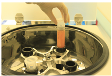 stem cells